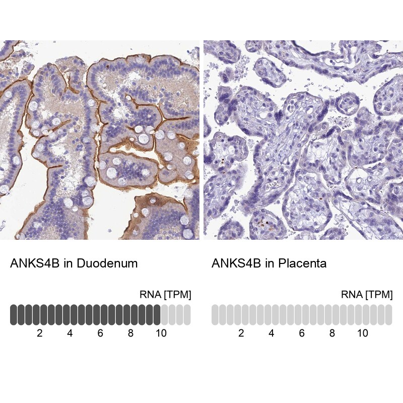 ANKS4B Antibody - BSA Free Immunohistochemistry: ANKS4B Antibody - BSA Free [NBP1-91672]