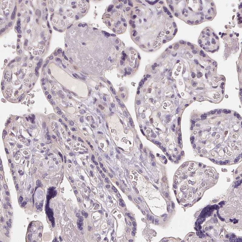 Aquaporin-8 Antibody - BSA Free Immunohistochemistry: Aquaporin-8 Antibody - BSA Free [NBP1-91676]
