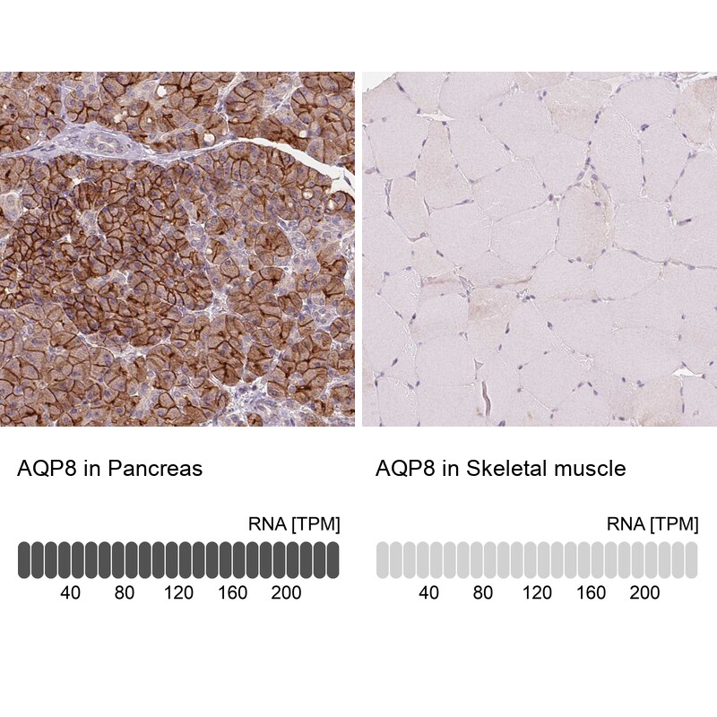 Aquaporin-8 Antibody - BSA Free Immunohistochemistry: Aquaporin-8 Antibody - BSA Free [NBP1-91676]