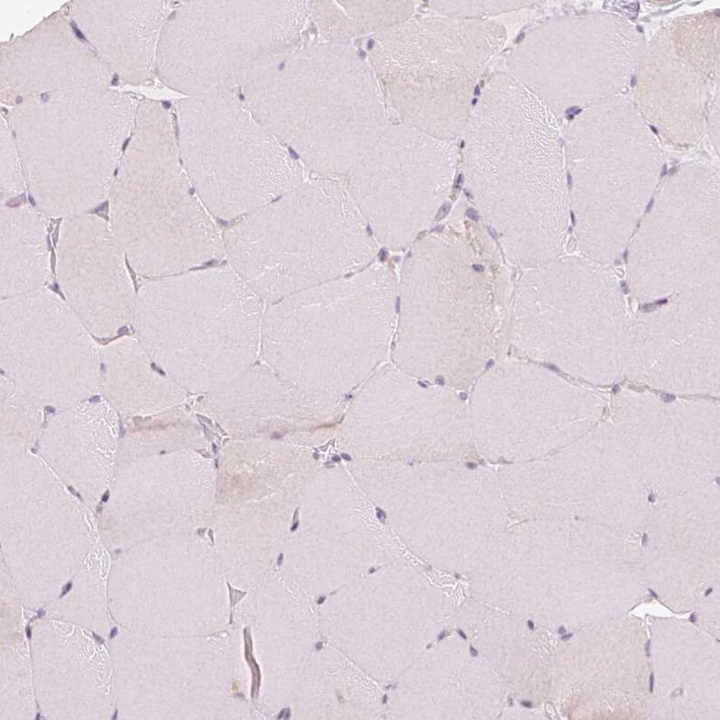 Aquaporin-8 Antibody - BSA Free Immunohistochemistry: Aquaporin-8 Antibody - BSA Free [NBP1-91676]