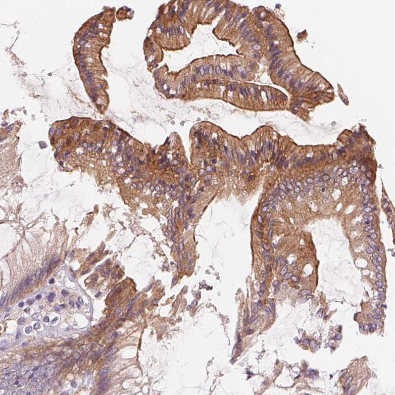 Aquaporin-8 Antibody - BSA Free Immunohistochemistry: Aquaporin-8 Antibody - BSA Free [NBP1-91676]