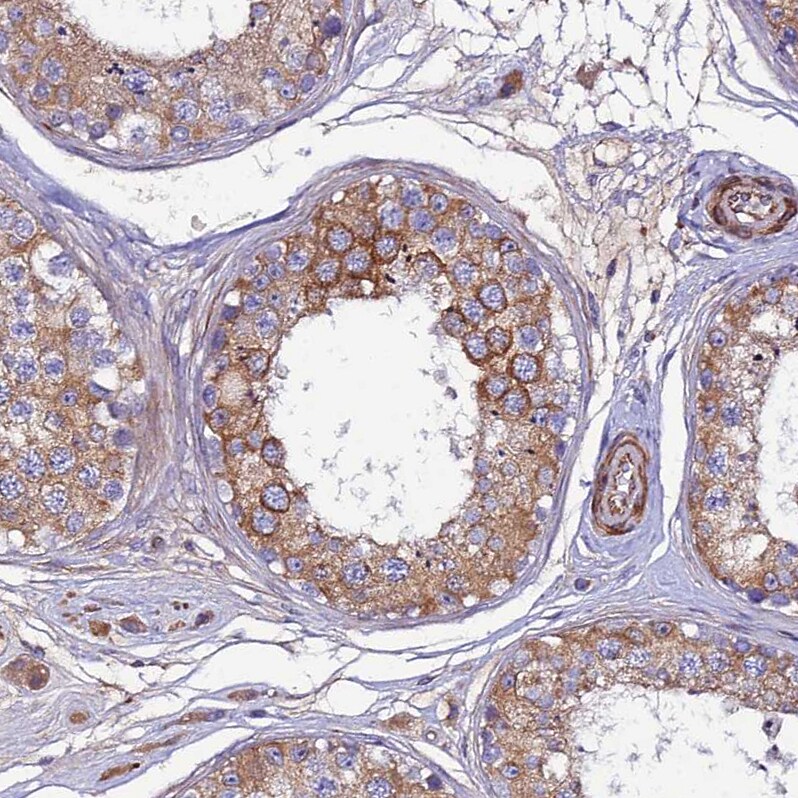 ARMER Antibody - BSA Free Immunohistochemistry: ARMER Antibody - BSA Free [NBP1-91681]