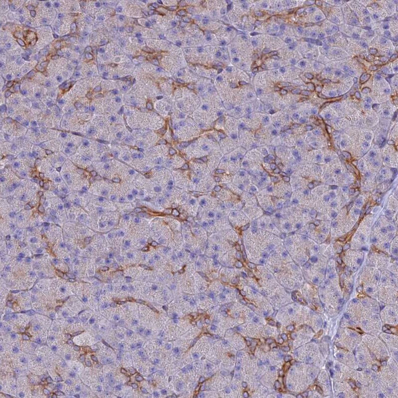 ARMER Antibody - BSA Free Immunohistochemistry: ARMER Antibody - BSA Free [NBP1-91681]