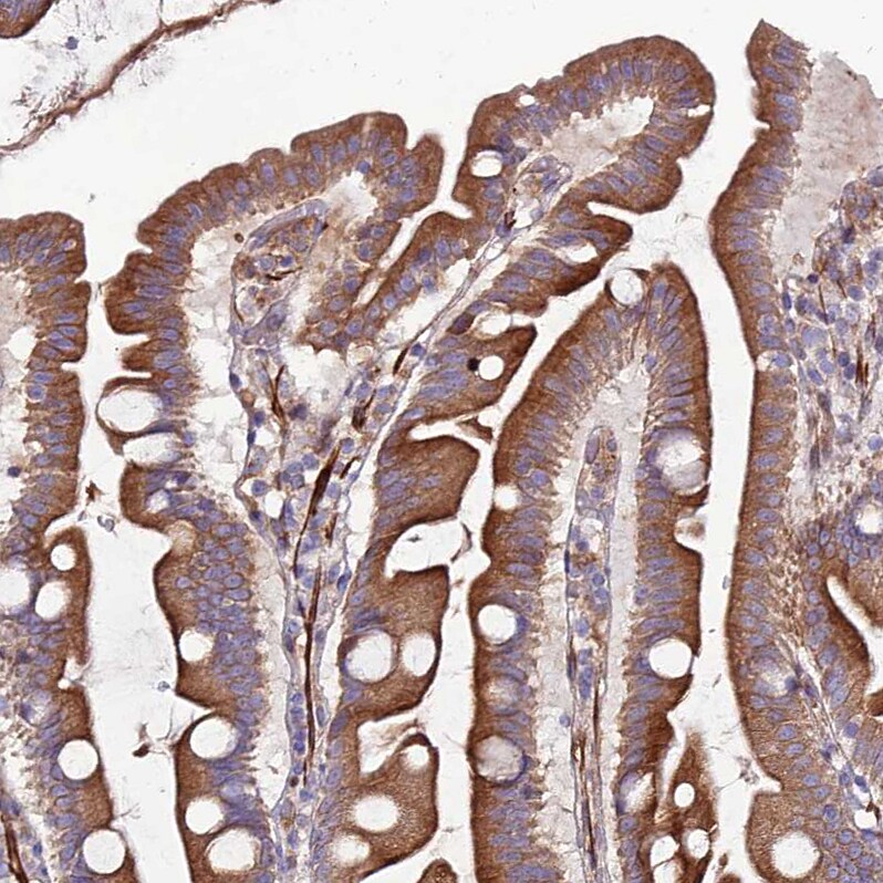 ARMER Antibody - BSA Free Immunohistochemistry: ARMER Antibody - BSA Free [NBP1-91681]
