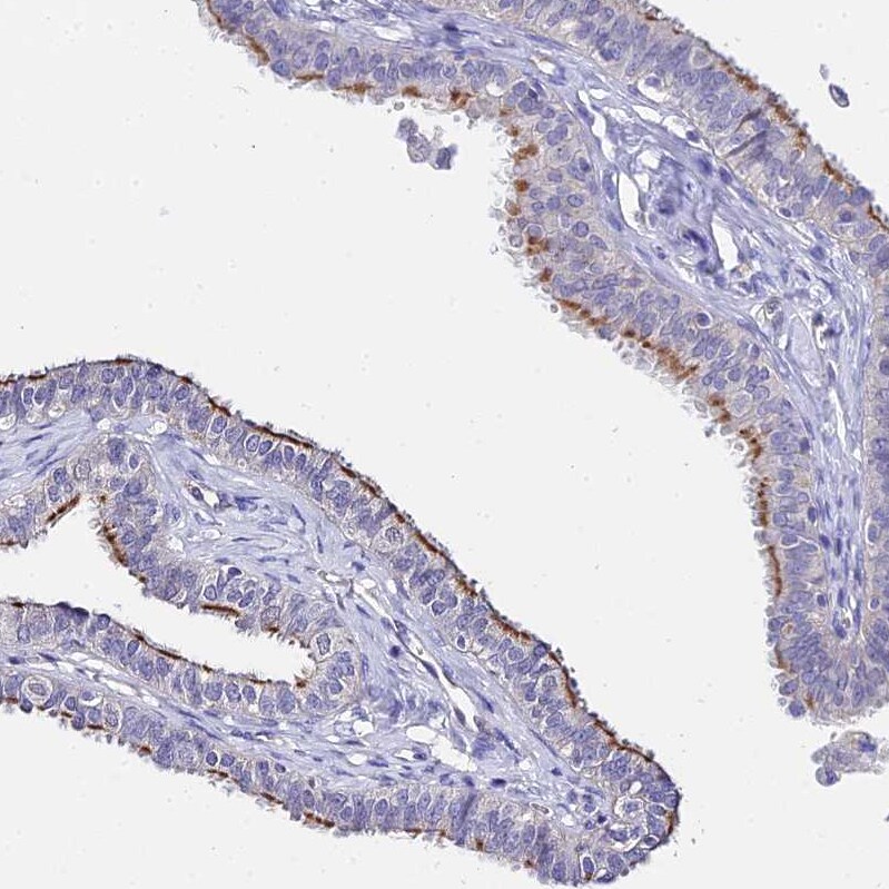 ARP10 Antibody - BSA Free Immunohistochemistry: ARP10 Antibody - BSA Free [NBP1-91682]