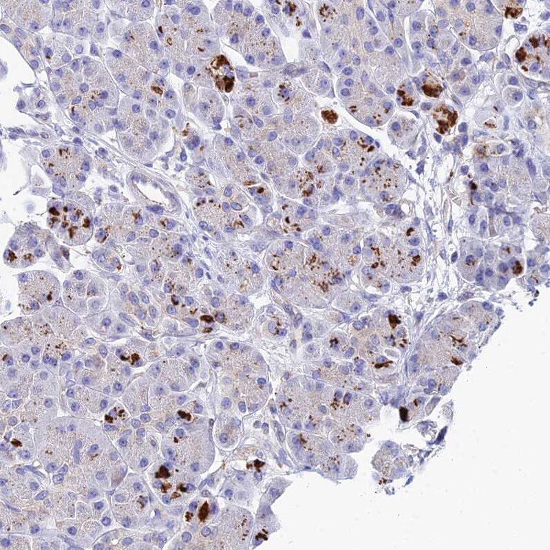 ARP10 Antibody - BSA Free Immunohistochemistry: ARP10 Antibody - BSA Free [NBP1-91682]