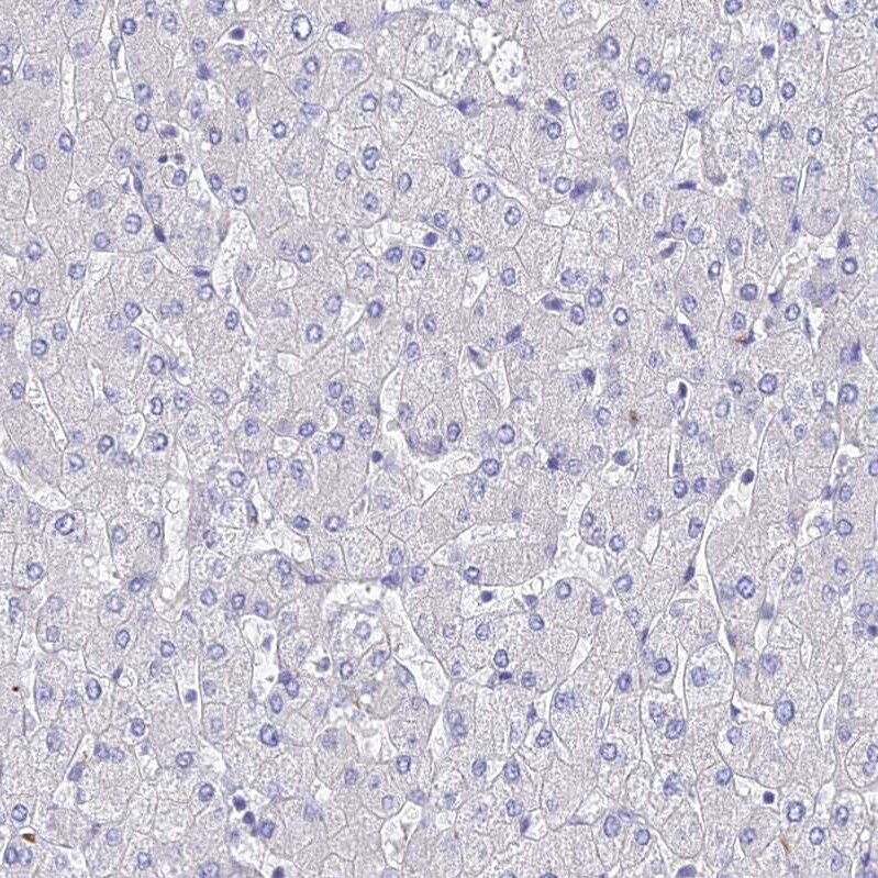ARP10 Antibody - BSA Free Immunohistochemistry: ARP10 Antibody - BSA Free [NBP1-91682]