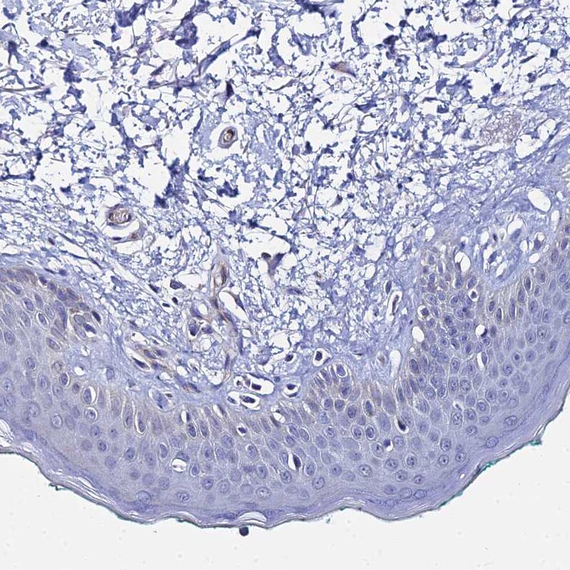 ARP10 Antibody - BSA Free Immunohistochemistry: ARP10 Antibody - BSA Free [NBP1-91682]