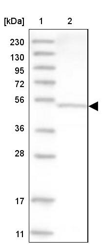 Aspartyl Aminopeptidase Antibody - BSA Free Western Blot: Aspartyl Aminopeptidase Antibody - BSA Free [NBP1-91684]