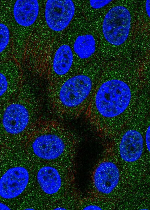 Aspartyl Aminopeptidase Antibody - BSA Free Immunocytochemistry/ Immunofluorescence: Aspartyl Aminopeptidase Antibody - BSA Free [NBP1-91685]