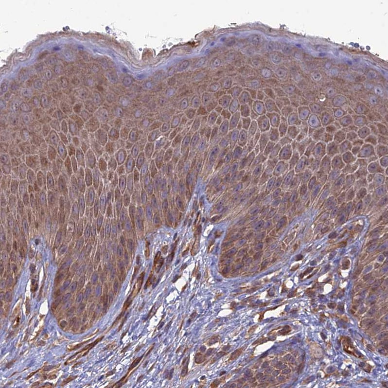ATP6V0A2 Antibody - BSA Free Immunohistochemistry: ATP6V0A2 Antibody - BSA Free [NBP1-91690]