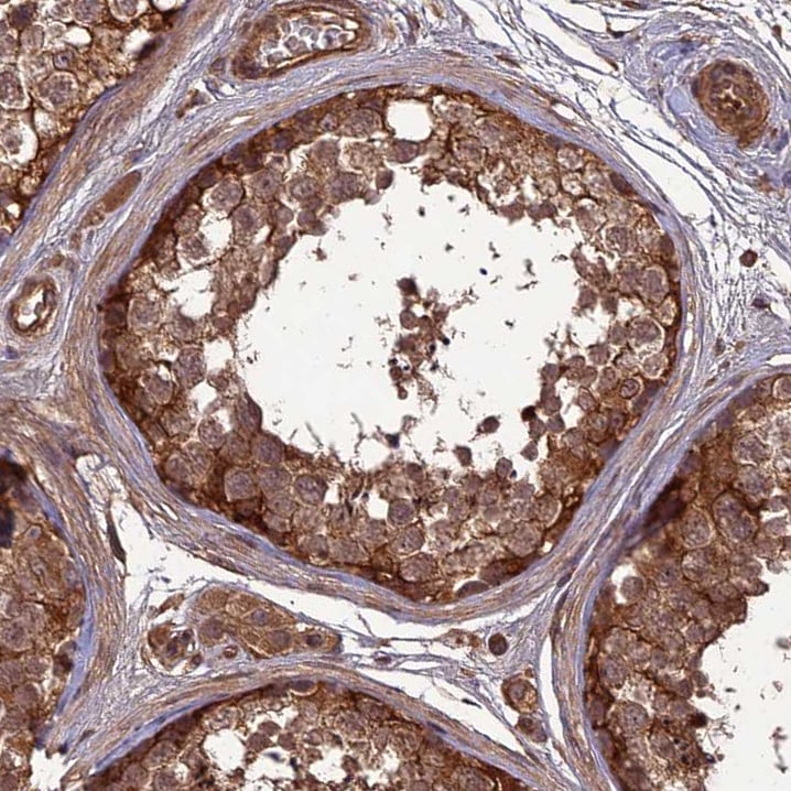 ATP6V0A2 Antibody - BSA Free Immunohistochemistry: ATP6V0A2 Antibody - BSA Free [NBP1-91690]