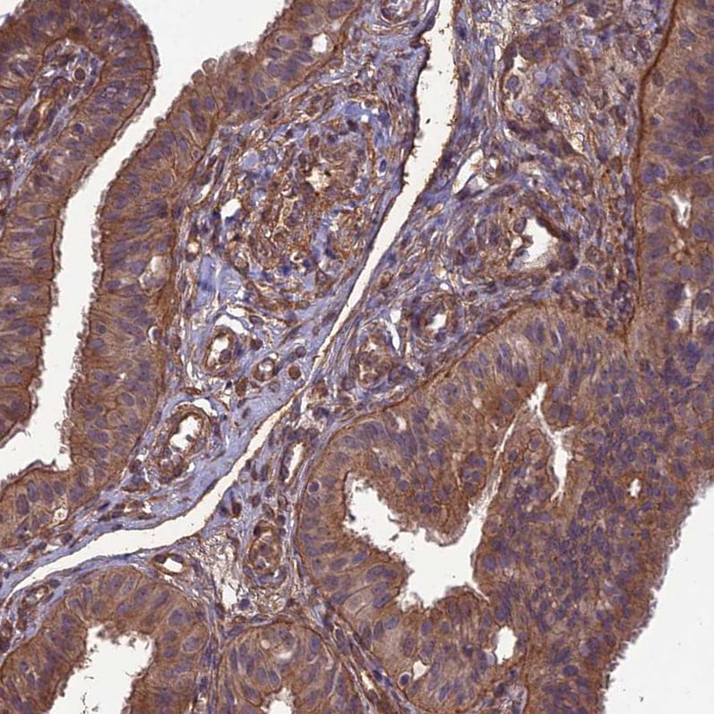 ATP6V0A2 Antibody - BSA Free Immunohistochemistry: ATP6V0A2 Antibody - BSA Free [NBP1-91690]