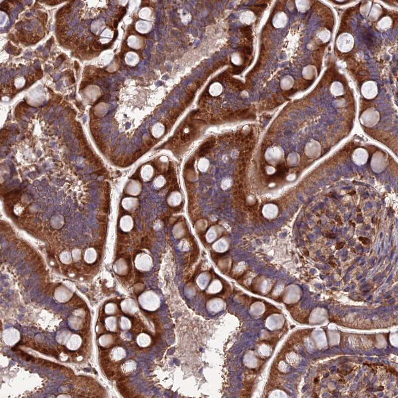 ATP6V0A2 Antibody - BSA Free Immunohistochemistry: ATP6V0A2 Antibody - BSA Free [NBP1-91690]
