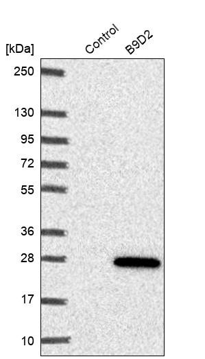 B9D2 Antibody - BSA Free Western Blot: B9D2 Antibody - BSA Free [NBP1-91694]