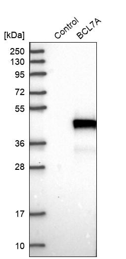 Bcl 7A Antibody - BSA Free Western Blot: Bcl 7A Antibody - BSA Free [NBP1-91696]