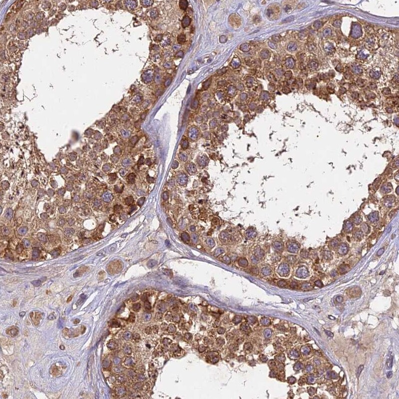 BRAP Antibody - BSA Free Immunohistochemistry-Paraffin: BRAP Antibody [NBP1-91705]