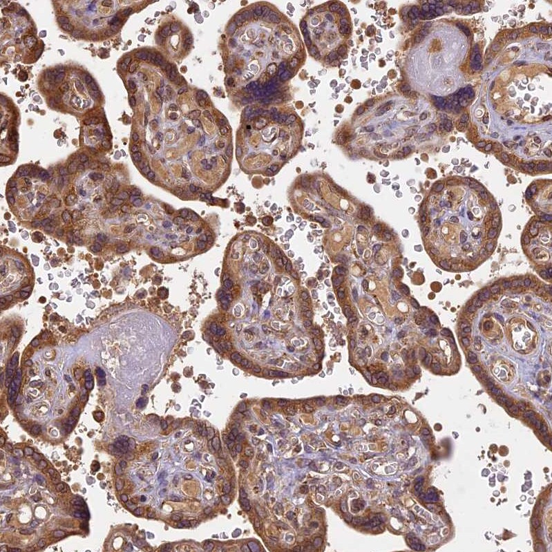 BRAP Antibody - BSA Free Immunohistochemistry-Paraffin: BRAP Antibody [NBP1-91705]
