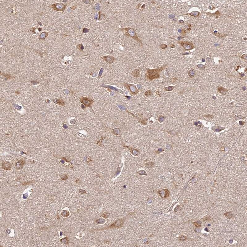 BRAP Antibody - BSA Free Immunohistochemistry-Paraffin: BRAP Antibody [NBP1-91705]