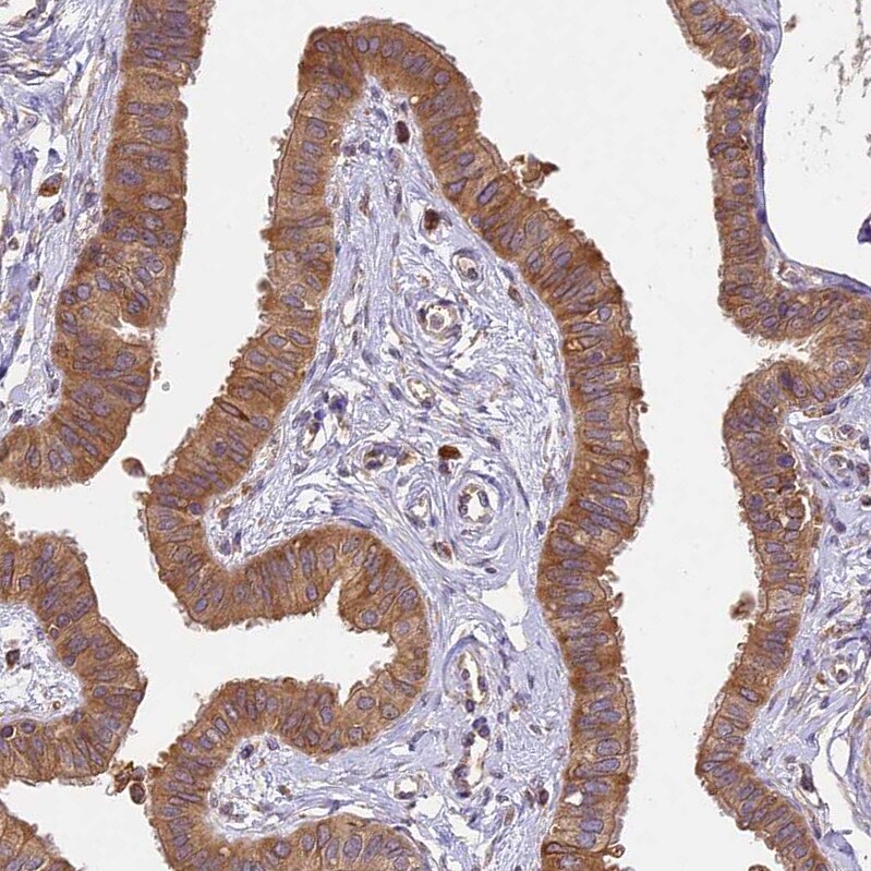 BRAP Antibody - BSA Free Immunohistochemistry-Paraffin: BRAP Antibody [NBP1-91705]
