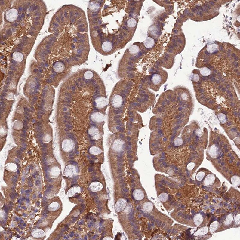 TMEM258 Antibody - BSA Free Immunohistochemistry: TMEM258 Antibody - BSA Free [NBP1-91711]