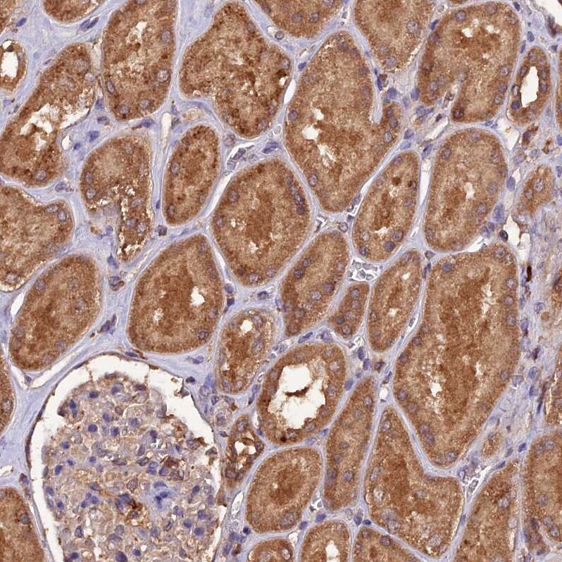 TMEM258 Antibody - BSA Free Immunohistochemistry: TMEM258 Antibody - BSA Free [NBP1-91711]