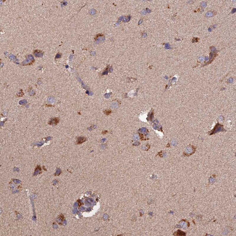 TMEM258 Antibody - BSA Free Immunohistochemistry: TMEM258 Antibody - BSA Free [NBP1-91711]