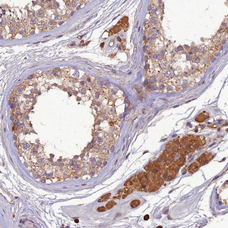 TMEM258 Antibody - BSA Free Immunohistochemistry: TMEM258 Antibody - BSA Free [NBP1-91711]