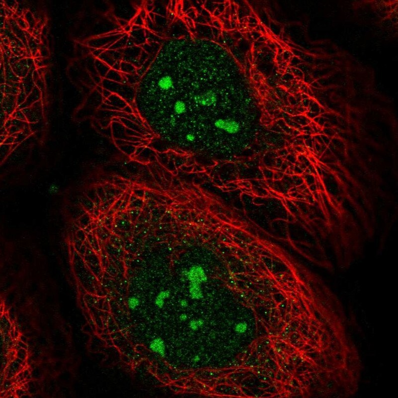 Custos Antibody - BSA Free Immunocytochemistry/ Immunofluorescence: Custos Antibody - BSA Free [NBP1-91713]