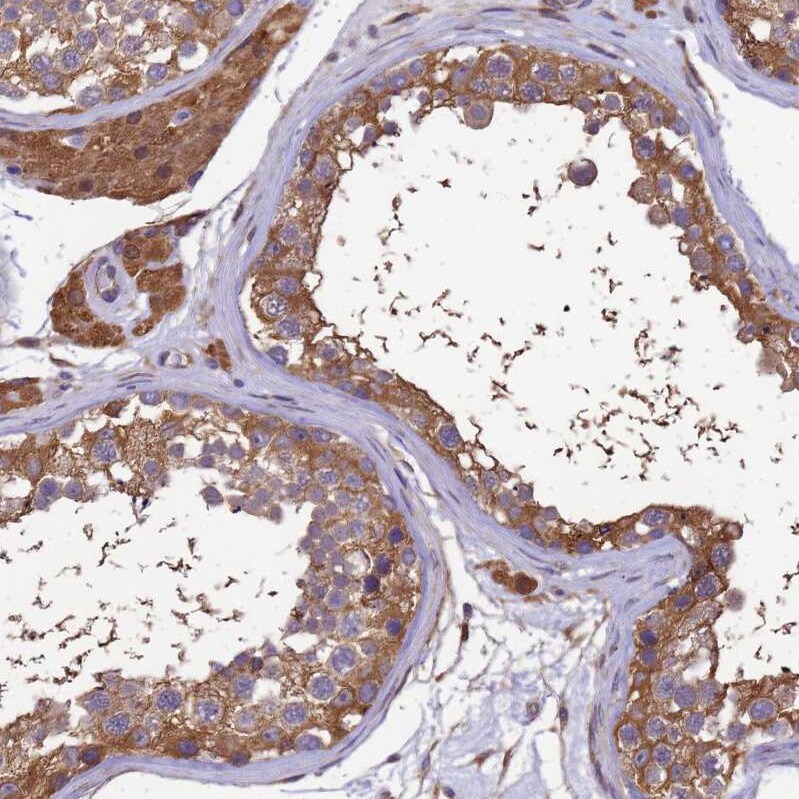 GID4 Antibody - BSA Free Immunohistochemistry: GID4 Antibody - BSA Free [NBP1-91717]