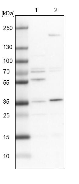 C19orf47 Antibody - BSA Free Western Blot: C19orf47 Antibody - BSA Free [NBP1-91722]