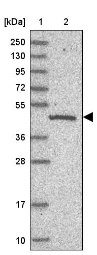C19orf47 Antibody - BSA Free Western Blot: C19orf47 Antibody - BSA Free [NBP1-91722]