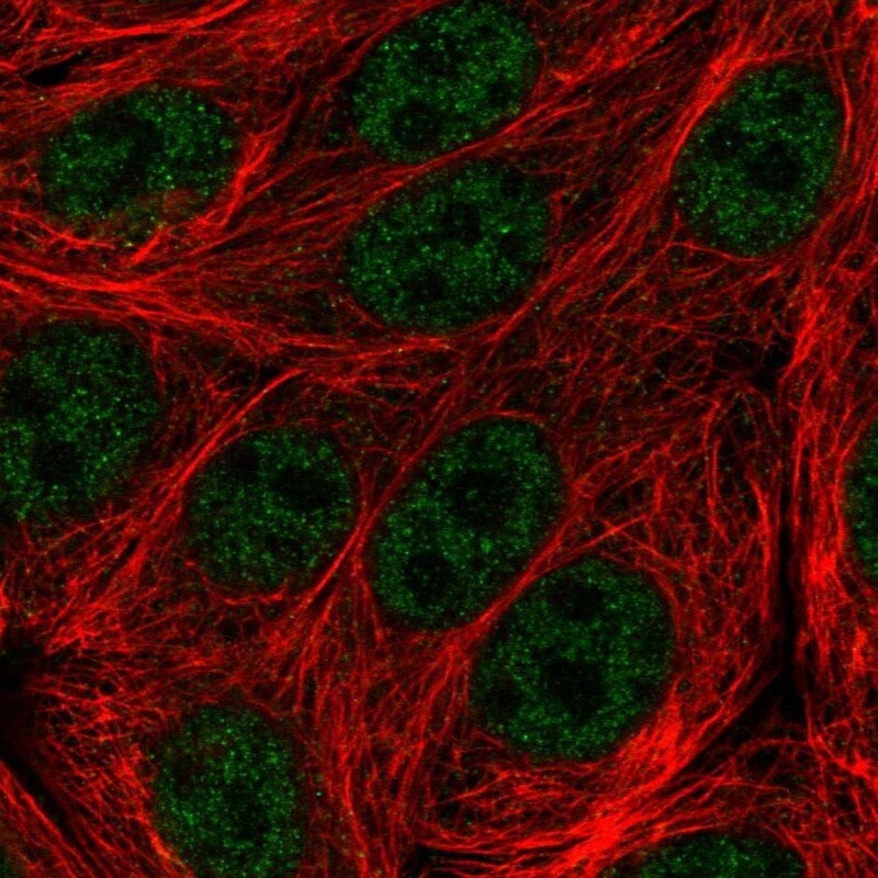 C19orf47 Antibody - BSA Free Immunocytochemistry/ Immunofluorescence: C19orf47 Antibody - BSA Free [NBP1-91722]