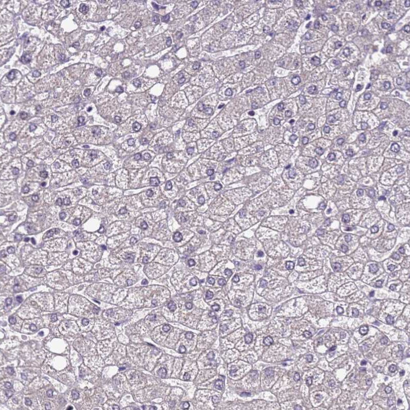 C19orf47 Antibody - BSA Free Immunohistochemistry: C19orf47 Antibody - BSA Free [NBP1-91723]
