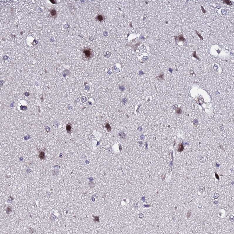 C19orf47 Antibody - BSA Free Immunohistochemistry: C19orf47 Antibody - BSA Free [NBP1-91723]