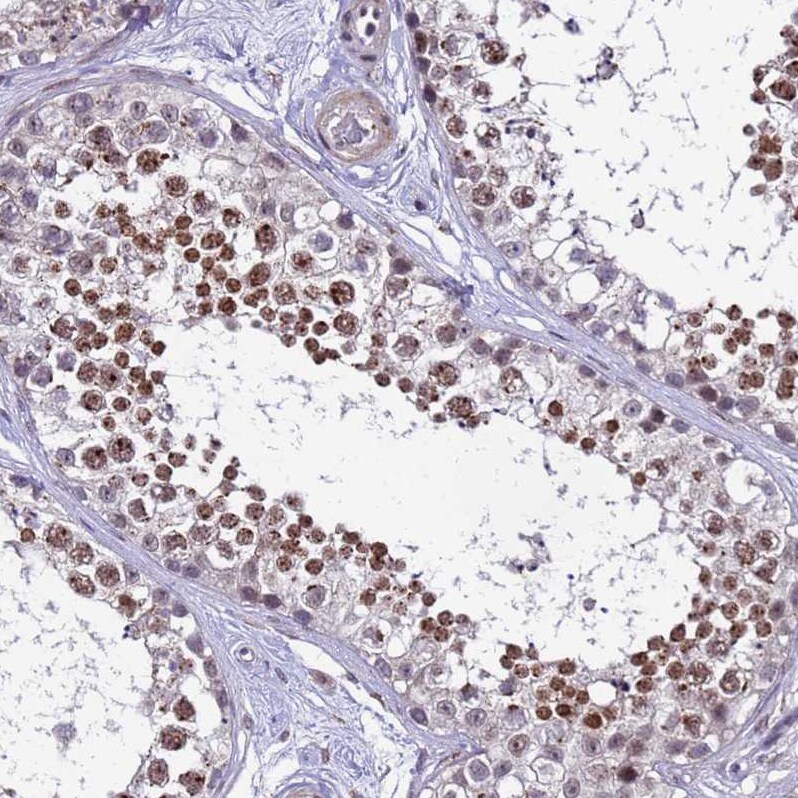 C19orf47 Antibody - BSA Free Immunohistochemistry: C19orf47 Antibody - BSA Free [NBP1-91723]