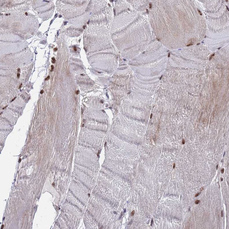 C19orf47 Antibody - BSA Free Immunohistochemistry: C19orf47 Antibody - BSA Free [NBP1-91723]