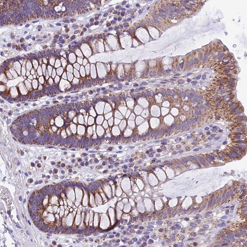 MGME1 Antibody - BSA Free Immunohistochemistry-Paraffin: MGME1 Antibody [NBP1-91726]