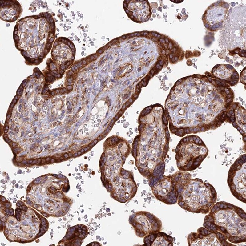 midA Antibody - BSA Free Immunohistochemistry: midA Antibody - BSA Free [NBP1-91728]