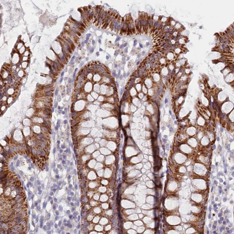 C6orf223 Antibody - BSA Free Immunohistochemistry: C6orf223 Antibody - BSA Free [NBP1-91738]