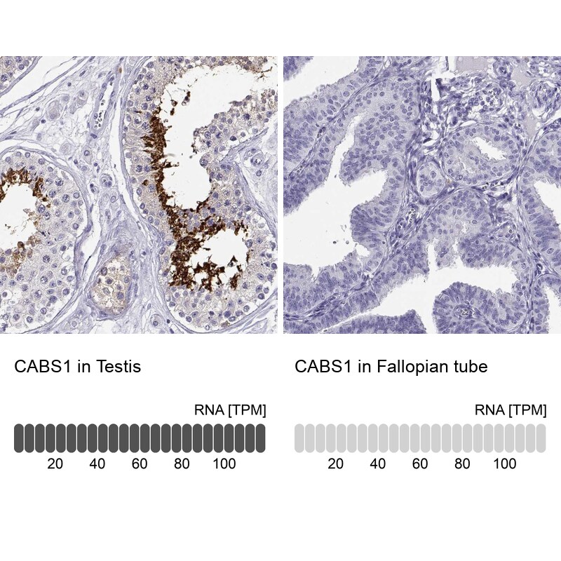 CABS1 Antibody - BSA Free Immunohistochemistry: CABS1 Antibody - BSA Free [NBP1-91743]