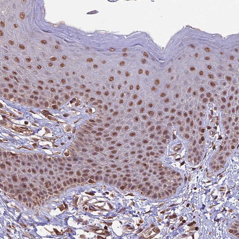 CAIN Antibody - BSA Free Immunohistochemistry: CAIN Antibody - BSA Free [NBP1-91745]