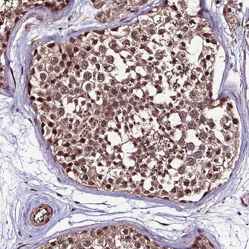 CAIN Antibody - BSA Free Immunohistochemistry: CAIN Antibody - BSA Free [NBP1-91745]