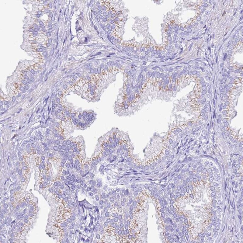 CASD1 Antibody - BSA Free Immunohistochemistry: CASD1 Antibody - BSA Free [NBP1-91750]