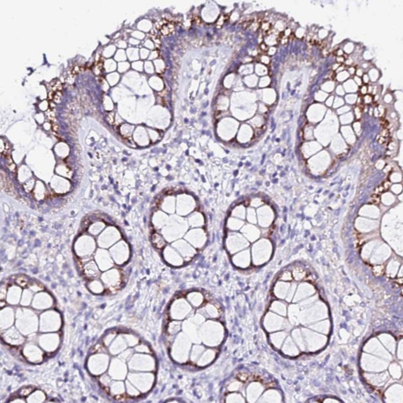 CASD1 Antibody - BSA Free Immunohistochemistry: CASD1 Antibody - BSA Free [NBP1-91750]