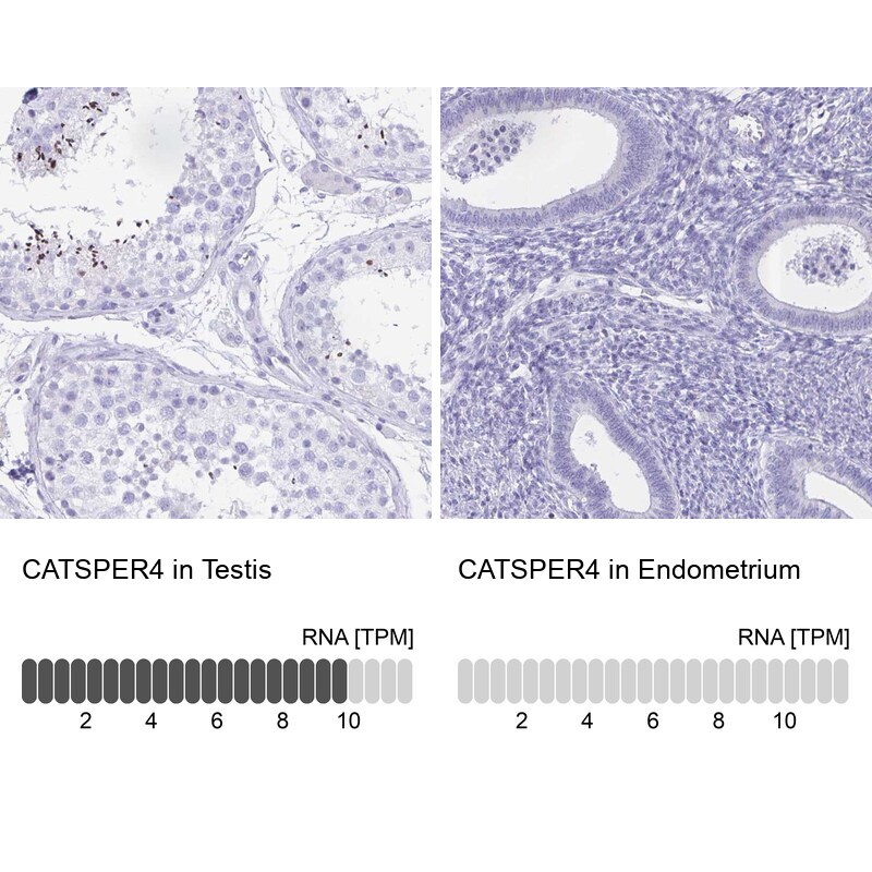 CATSPER4 Antibody - BSA Free Immunohistochemistry: CATSPER4 Antibody - BSA Free [NBP1-91751]