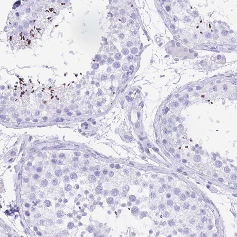 CATSPER4 Antibody - BSA Free Immunohistochemistry: CATSPER4 Antibody - BSA Free [NBP1-91751]