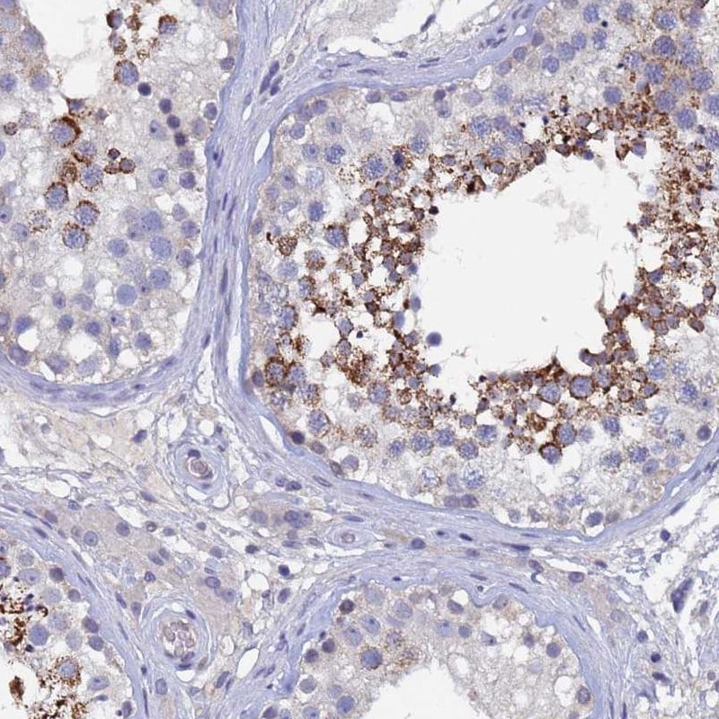 CCDC36 Antibody - BSA Free Immunohistochemistry: CCDC36 Antibody - BSA Free [NBP1-91760]