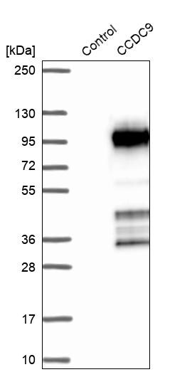 CCDC9 Antibody - BSA Free Western Blot: CCDC9 Antibody - BSA Free [NBP1-91765]