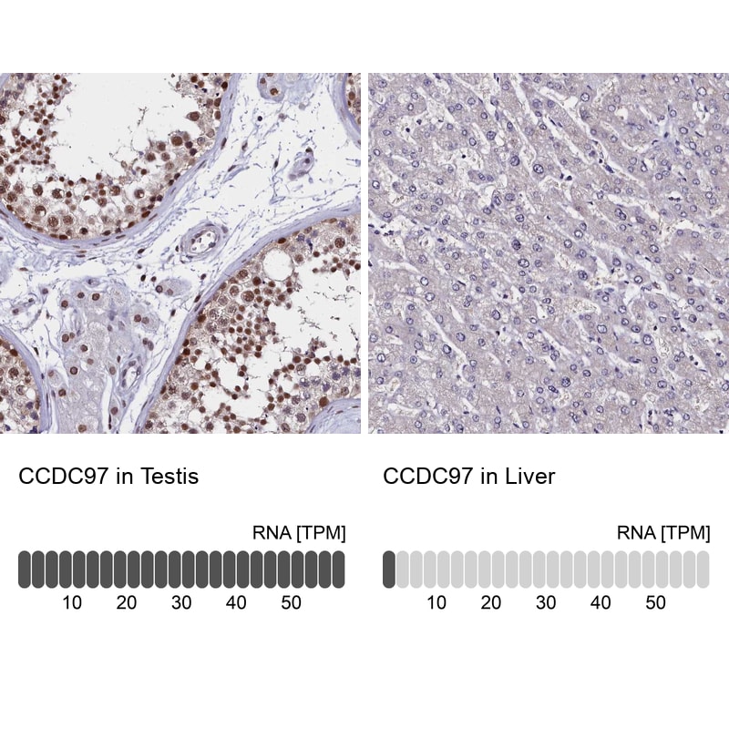 CCDC97 Antibody - BSA Free Immunohistochemistry: CCDC97 Antibody - BSA Free [NBP1-91767]